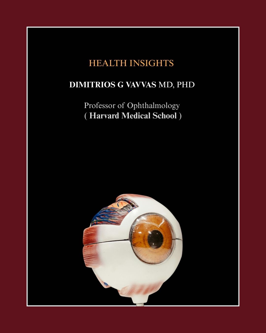 Regression of Some High-risk Features of Age-related Macular Degeneration (AMD) in Patients Receiving Intensive Statin Treatment