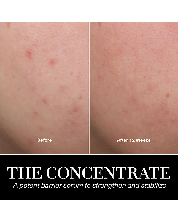 La Mer The Concentrate - xiceditorial - xic editorial